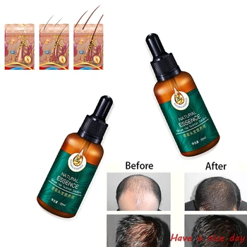 7 Dní Zázvor Růst Vlasů Sérum 30ML Anti Prevenci vypadávání Vlasů Alopecie Kapalina Poškozené Vlasy Repair Roste Rychleji